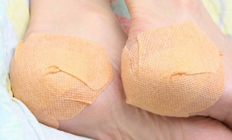 Боли в пятках