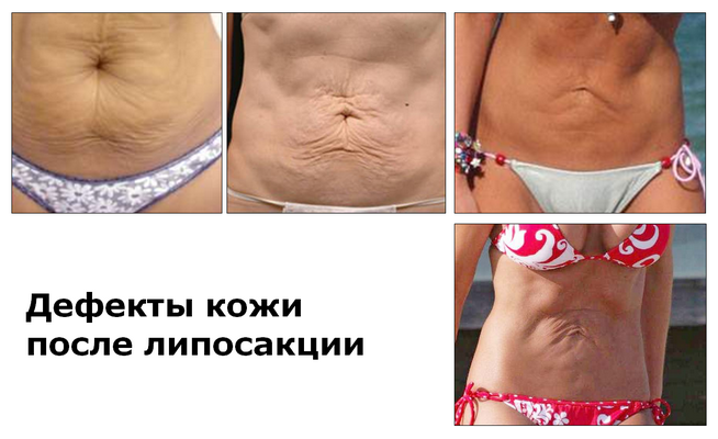 Дефекты кожи